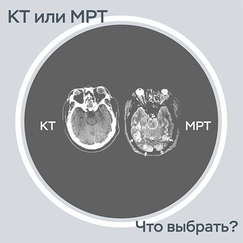 Основное отличие КТ и МРТ