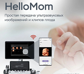 HelloMom - Простая передача ультразвуковых изображений и клипов плода