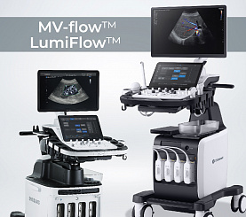MV-flow™ и LumiFlow™ в УЗИ-аппаратах Heka и Samsung
